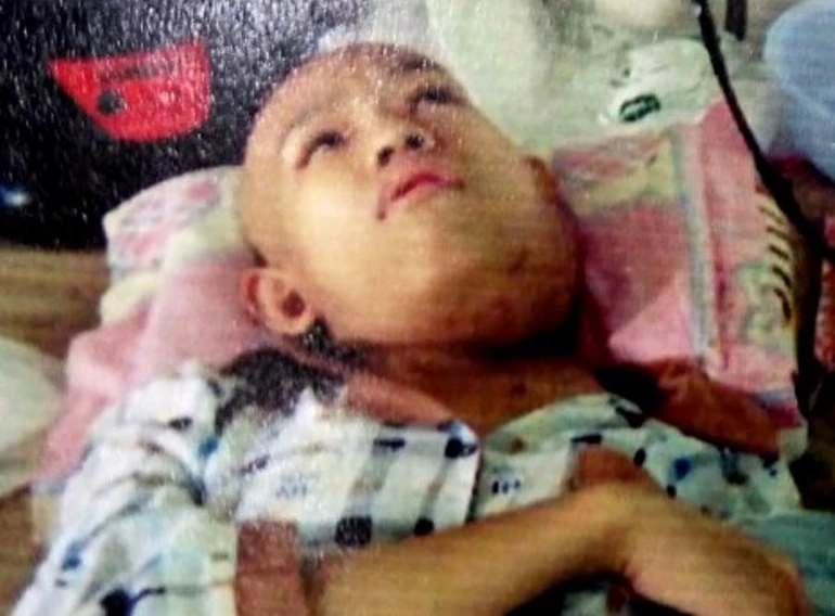 Cháu Ánh Hào cần cứu giúp